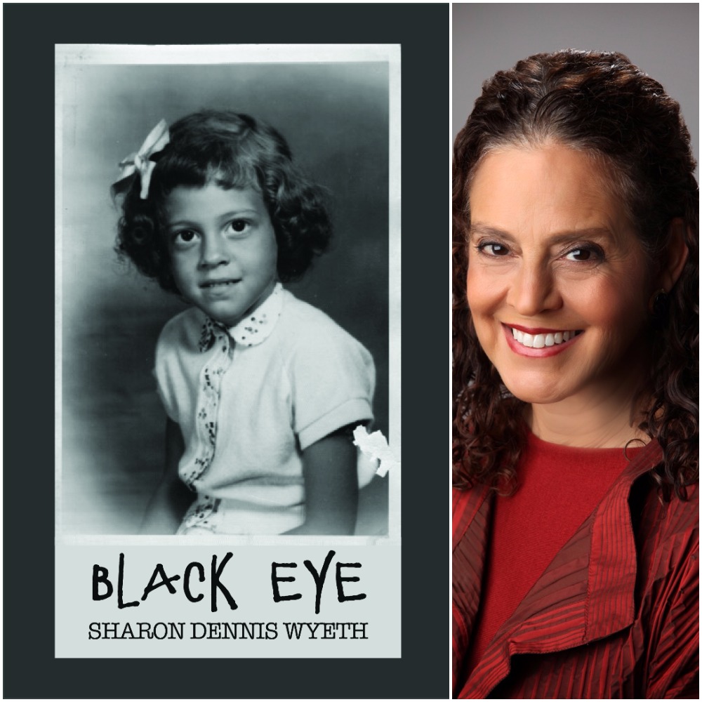 Black Eye By Sharon Dennis Wyeth Finishing Line Press 